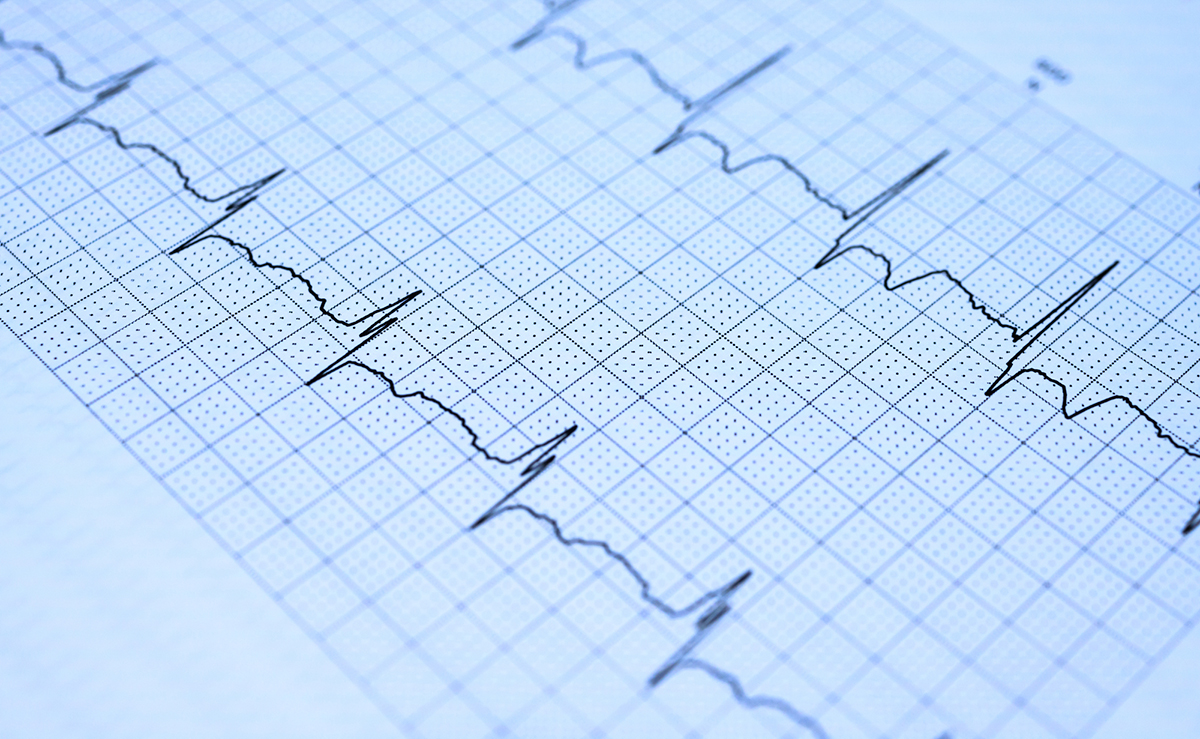心電図異常と指摘されたら…